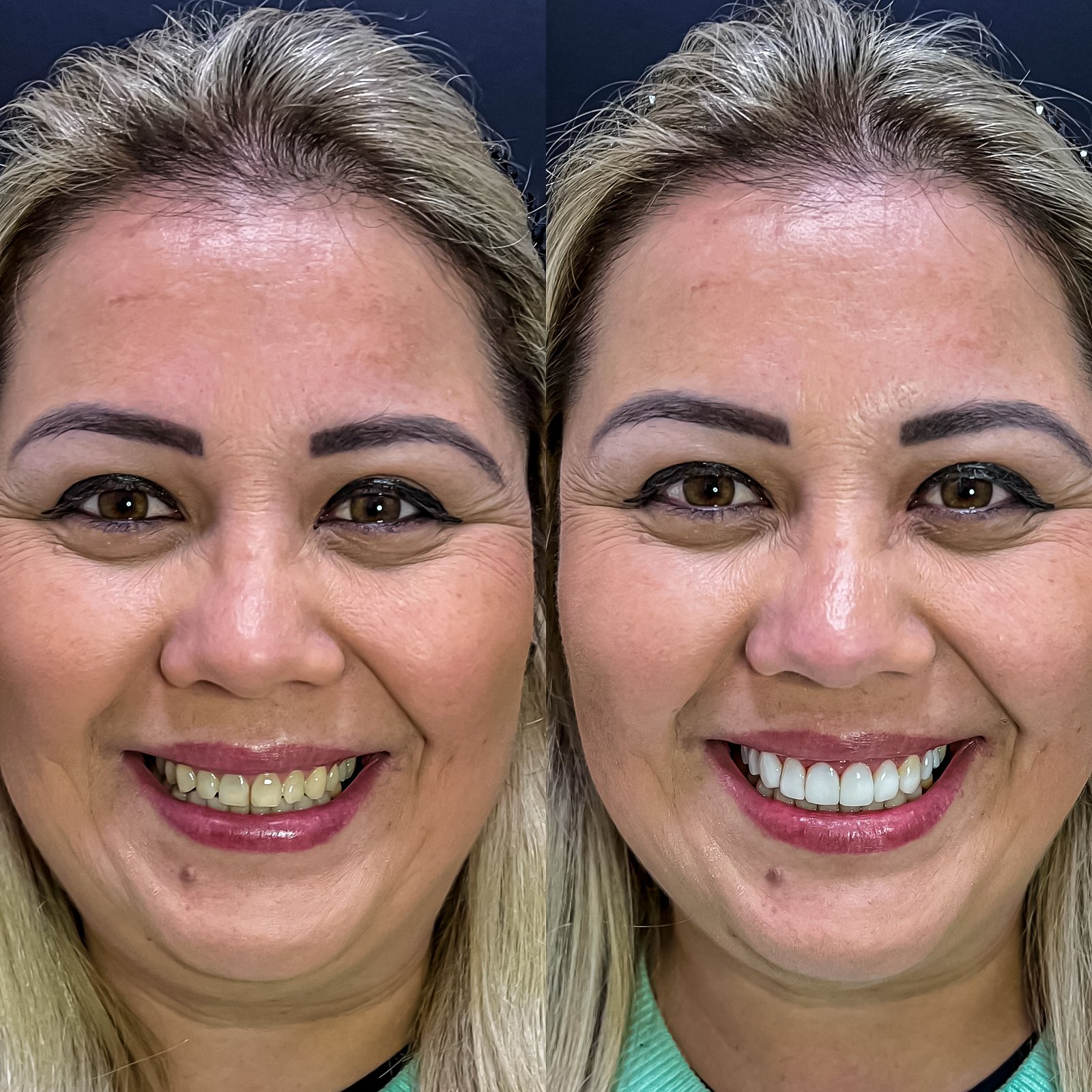 9333BABC-E919-43A0-8896-E67A24C7FFD8